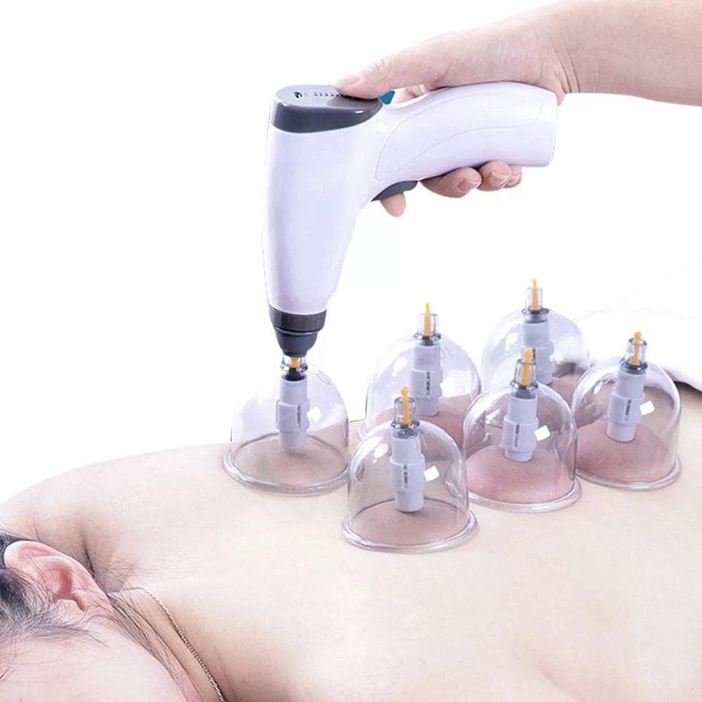 Zuignap Anti Cellulite Elektri - Cupping Therapy Set recensie en prijs