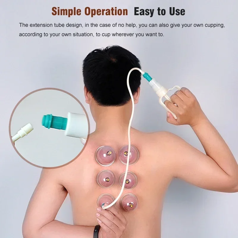 32-delige vacuüm cupping cup b - Cupping Therapy Set recensie en prijs