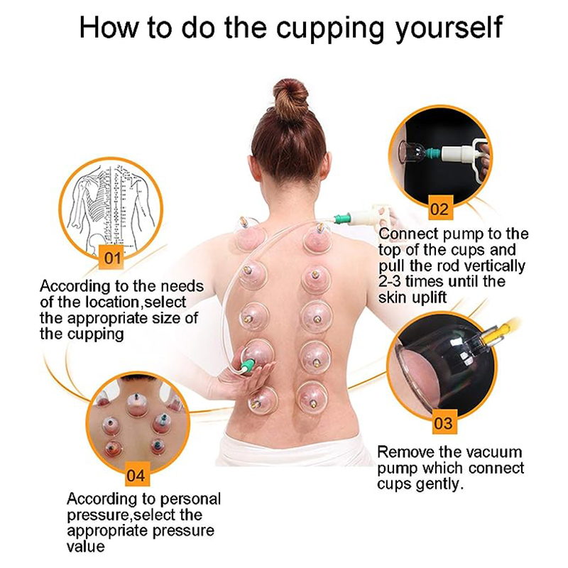 24-blikjes JINGKANG Chinese va - Cupping Therapy Set recensie en prijs