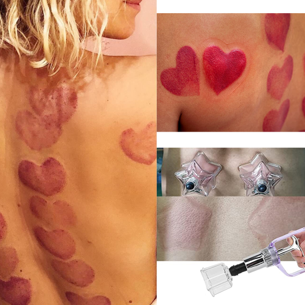 Nieuwe Stijl 4 Stuks Love-Star - Cupping Therapy Set recensie en prijs